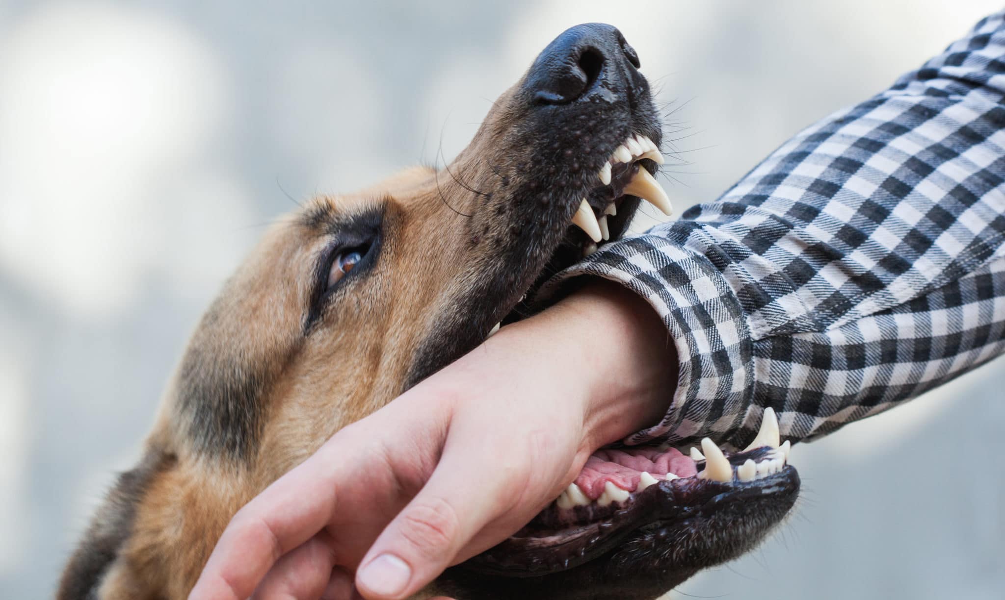 Caring for Your Dog Bite Injury | Denver, CO | Pushchak Law