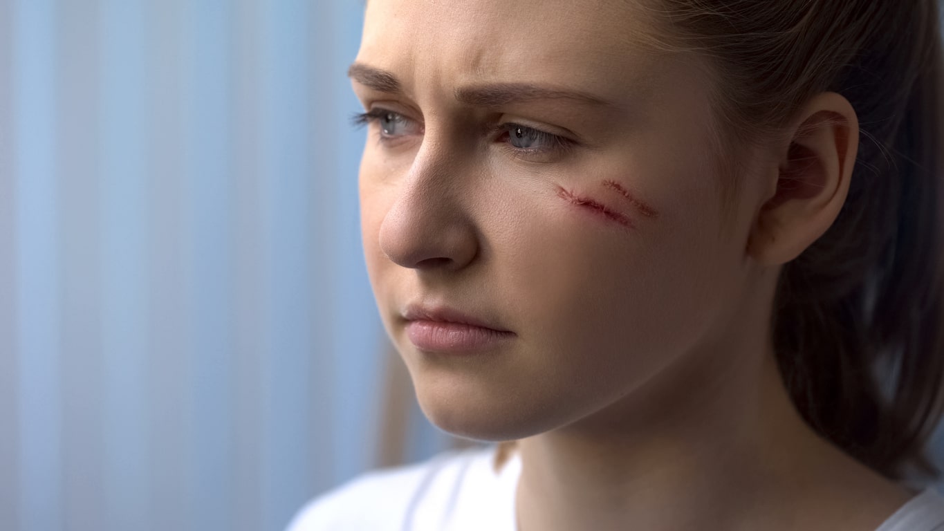 Plastic and Reconstructive Surgery After a Dog Bite